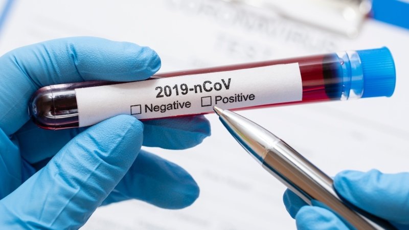 Hoaxy a fake news mohou mít vliv na dodržování pandemických opatření a tím na vývoj epidemie. Zdroj: Ingimage
