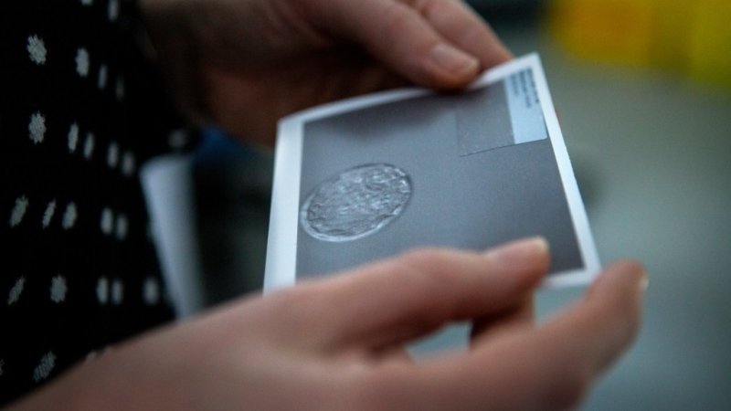 7 mýtů o umělém oplodnění, které je třeba uvést na pravou míru
