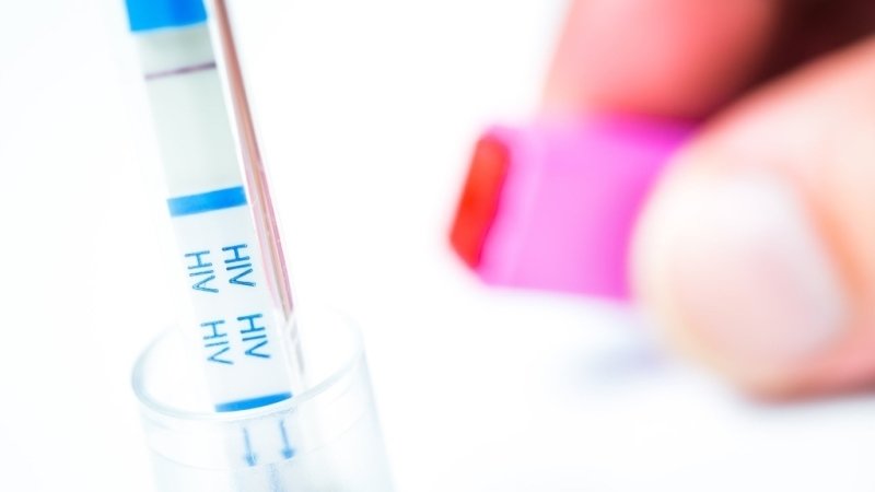 Jak se chovat k lidem s HIV? Rozhodně bez předsudků, říká psychoterapeut Domu světla