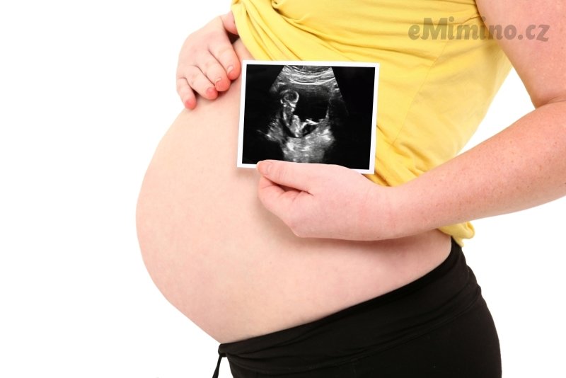 Chtěla bych druhé, ale po prvním porodu se bojím