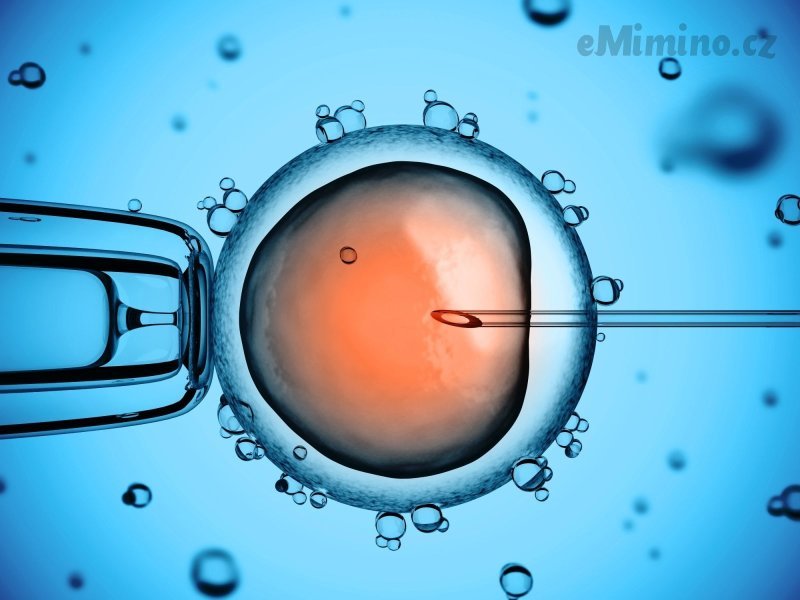 IVF: nevzdávám se, čeká mne další pokus
